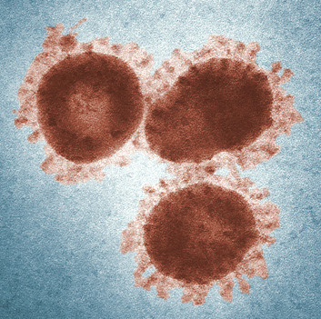 바이러스 이미지